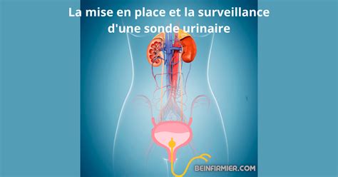 vivre avec une sonde urinaire|CONSEILS AU PATIENT PORTEUR D’UNE SONDE。